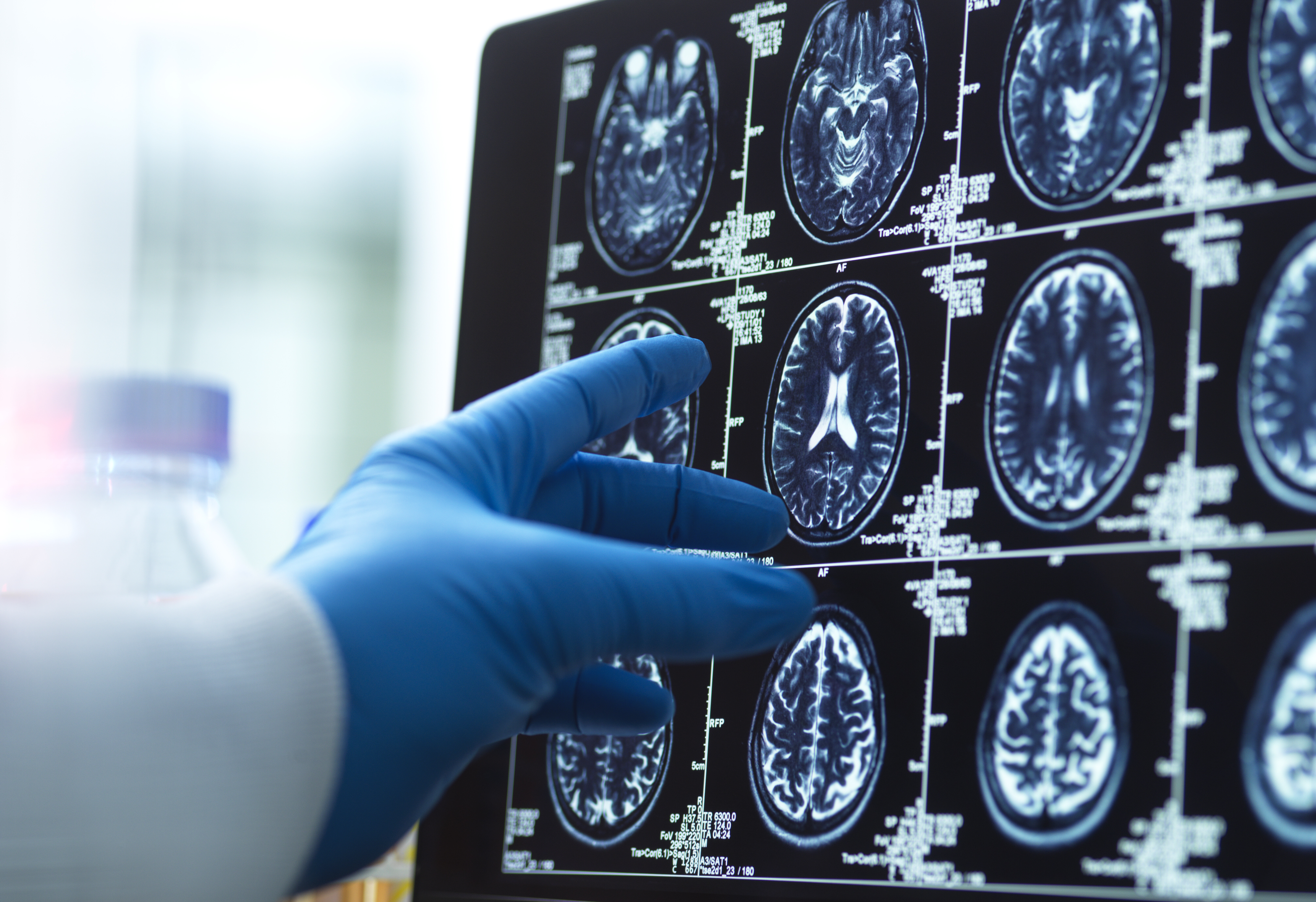 doctor-viewing-a-brain-scan-for-possible-ageing-an-2025-04-05-06-53-11-utc.jpg