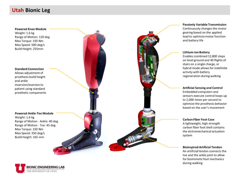 Bionic Leg